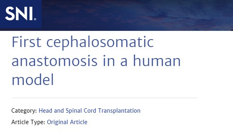 First cephalosomatic anastomosis in a human modelへのリンク画像です。